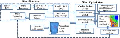 Computational Model for Therapy Optimization of Wearable Cardioverter Defibrillator: Shockable Rhythm Detection and Optimal Electrotherapy